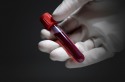FDA одобрило к применению тест Theranos на вирус герпеса